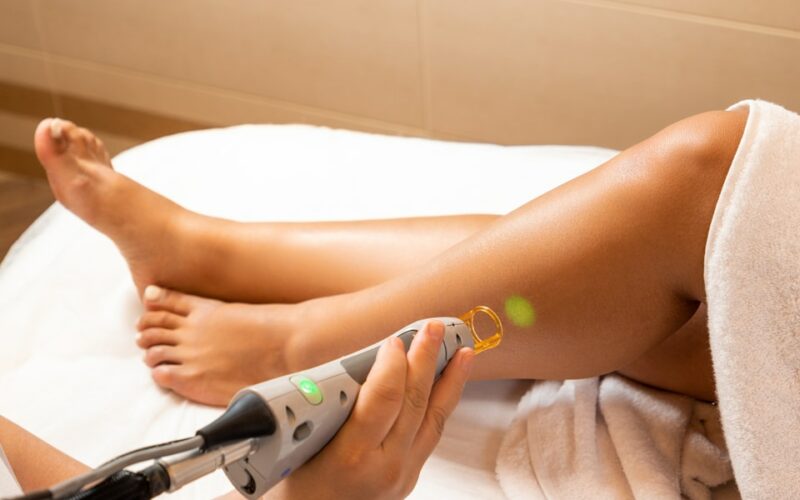 épilation laser préparation de la peau