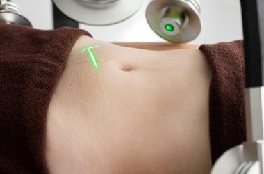 techniques liposuccion