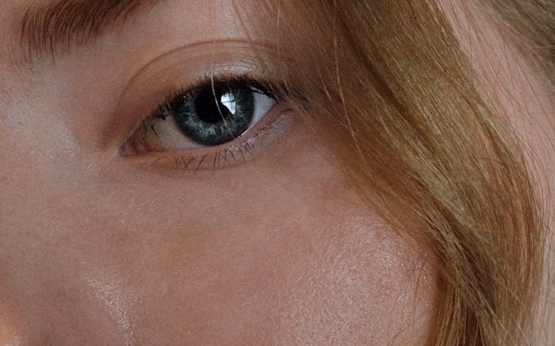 microneedling