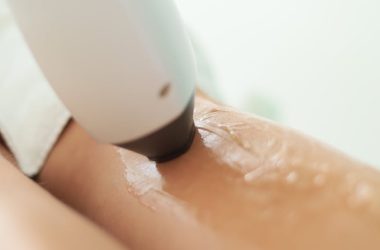 laser fractionne cicatrice