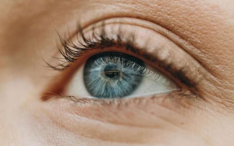 paupieres inferieures