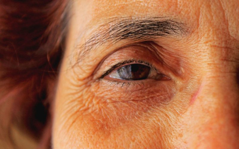 cernes menopause