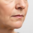 Comment effacer le sillon nasogénien sans chirurgie grâce aux injections ?