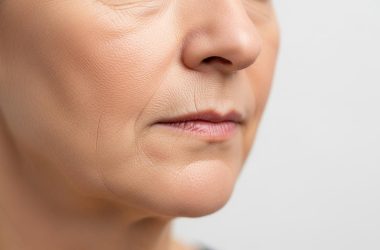 Comment effacer le sillon nasogénien sans chirurgie grâce aux injections ?