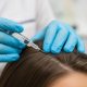 La mésothérapie capillaire : une solution efficace contre la chute de cheveux