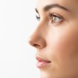 Comment corriger un nez sans chirurgie grâce à la rhinoplastie médicale ?
