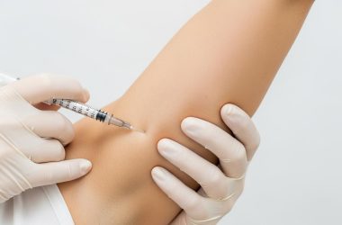 Botox contre la transpiration excessive : comment en finir avec l'hyperhidrose