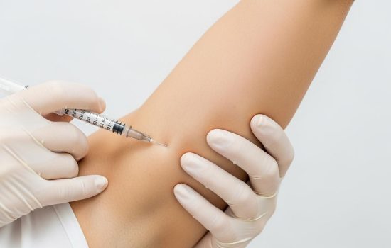 Botox contre la transpiration excessive : comment en finir avec l'hyperhidrose