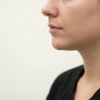 Chirurgie du menton : comment harmoniser le profil du visage durablement
