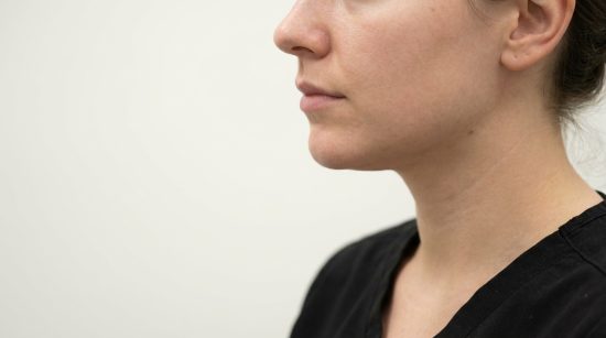 Chirurgie du menton : comment harmoniser le profil du visage durablement