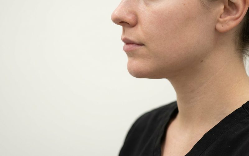 Chirurgie du menton : comment harmoniser le profil du visage durablement