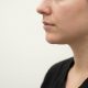 Chirurgie du menton : comment harmoniser le profil du visage durablement