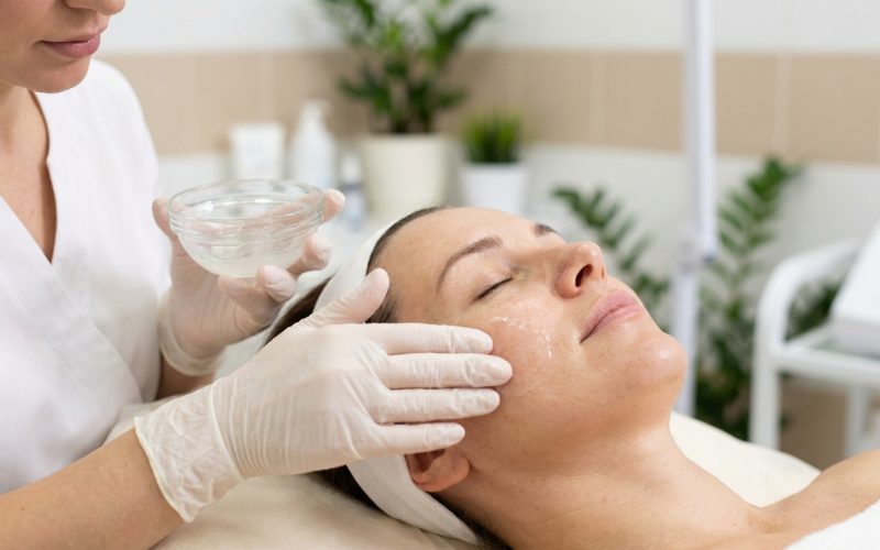 Le peeling pour effacer les taches pigmentaires : types et résultats attendus