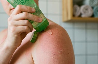 Comment réparer une peau brûlée par le soleil rapidement et efficacement ?