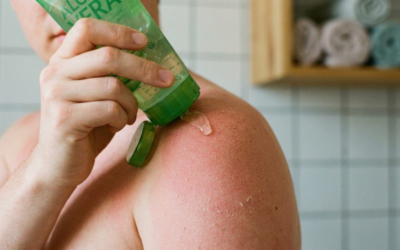 Comment réparer une peau brûlée par le soleil rapidement et efficacement ?