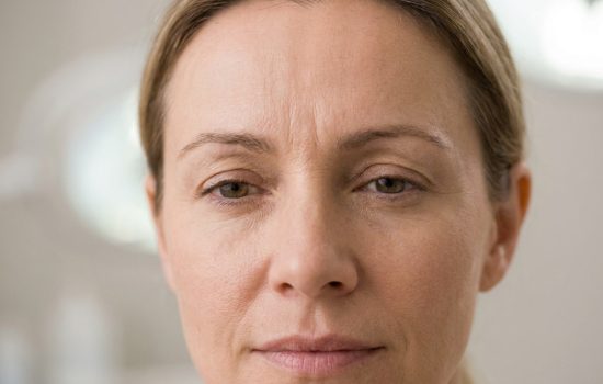 Comment traiter les rides du lion efficacement sans figer les expressions ?