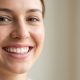 La chirurgie du sourire : comment corriger une gencive trop visible efficacement