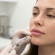 Injections lèvres : les techniques actuelles pour un résultat naturel et harmonieux